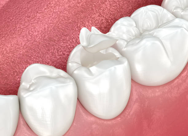 Professional Dental Services in Harvey, LA